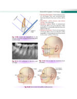 Textbook of Oral Medicine and Radiology 2021 - Image 5