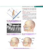 Textbook of Oral Medicine and Radiology 2021 - Image 5