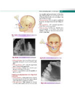 Textbook of Oral Medicine and Radiology 2021 - Image 6