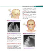 Textbook of Oral Medicine and Radiology 2021 - Image 6