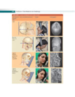 Textbook of Oral Medicine and Radiology 2021 - Image 8