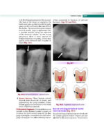 Textbook of Oral Medicine and Radiology 2021 - Image 9