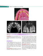 Textbook of Oral Medicine and Radiology 2021 - Image 10