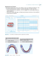 Aligner Techniques in Orthodontics 2021 - Image 5