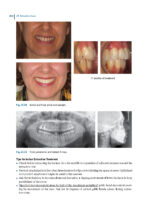 Aligner Techniques in Orthodontics 2021 - Image 8