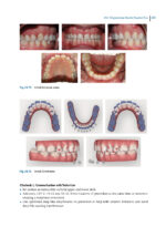 Aligner Techniques in Orthodontics 2021 - Image 9