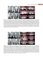 GROSSMAN’S ENDODONTIC PRACTICE 2021 (14th Edition) - Image 2