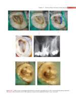 GROSSMAN’S ENDODONTIC PRACTICE 2021 (14th Edition) - Image 4