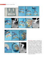 GROSSMAN’S ENDODONTIC PRACTICE 2021 (14th Edition) - Image 6