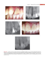 GROSSMAN’S ENDODONTIC PRACTICE 2021 (14th Edition) - Image 7