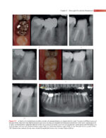 GROSSMAN’S ENDODONTIC PRACTICE 2021 (14th Edition) - Image 8