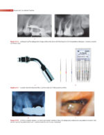 GROSSMAN’S ENDODONTIC PRACTICE 2021 (14th Edition) - Image 9