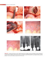 GROSSMAN’S ENDODONTIC PRACTICE 2021 (14th Edition) - Image 11