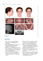 Recognizing and Correcting Developing Malocclusions: A Problem-Oriented Approach to Orthodontics 2025 - Image 2