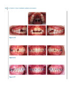 Recognizing and Correcting Developing Malocclusions: A Problem-Oriented Approach to Orthodontics 2025 - Image 3
