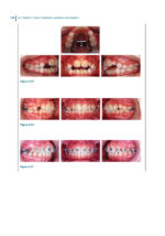 Recognizing and Correcting Developing Malocclusions: A Problem-Oriented Approach to Orthodontics 2025 - Image 3