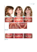Recognizing and Correcting Developing Malocclusions: A Problem-Oriented Approach to Orthodontics 2025 - Image 4