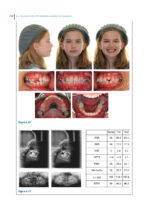 Recognizing and Correcting Developing Malocclusions: A Problem-Oriented Approach to Orthodontics 2025 - Image 5