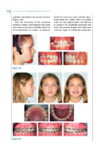 Recognizing and Correcting Developing Malocclusions: A Problem-Oriented Approach to Orthodontics 2025 - Image 7