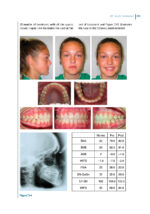 Recognizing and Correcting Developing Malocclusions: A Problem-Oriented Approach to Orthodontics 2025 - Image 8