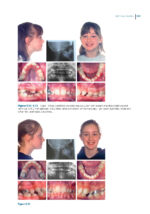 Recognizing and Correcting Developing Malocclusions: A Problem-Oriented Approach to Orthodontics 2025 - Image 9