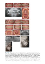 Recognizing and Correcting Developing Malocclusions: A Problem-Oriented Approach to Orthodontics 2025 - Image 10
