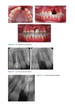 Recognizing and Correcting Developing Malocclusions: A Problem-Oriented Approach to Orthodontics 2025 - Image 11