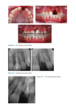 Recognizing and Correcting Developing Malocclusions: A Problem-Oriented Approach to Orthodontics 2025 - Image 11