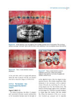 Recognizing and Correcting Developing Malocclusions: A Problem-Oriented Approach to Orthodontics 2025 - Image 12