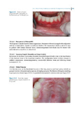 Pathological Basis of Oral and Maxillofacial Diseases 2025 - Image 4