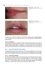 Pathological Basis of Oral and Maxillofacial Diseases 2025 - Image 5