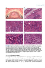 Pathological Basis of Oral and Maxillofacial Diseases 2025 - Image 8