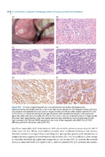 Pathological Basis of Oral and Maxillofacial Diseases 2025 - Image 9
