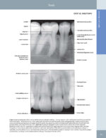 DIAGNOSTIC IMAGING: ORAL AND MAXILLOFACIAL - Koenig 2024 (THIRD EDITION) 2VOL - Image 8