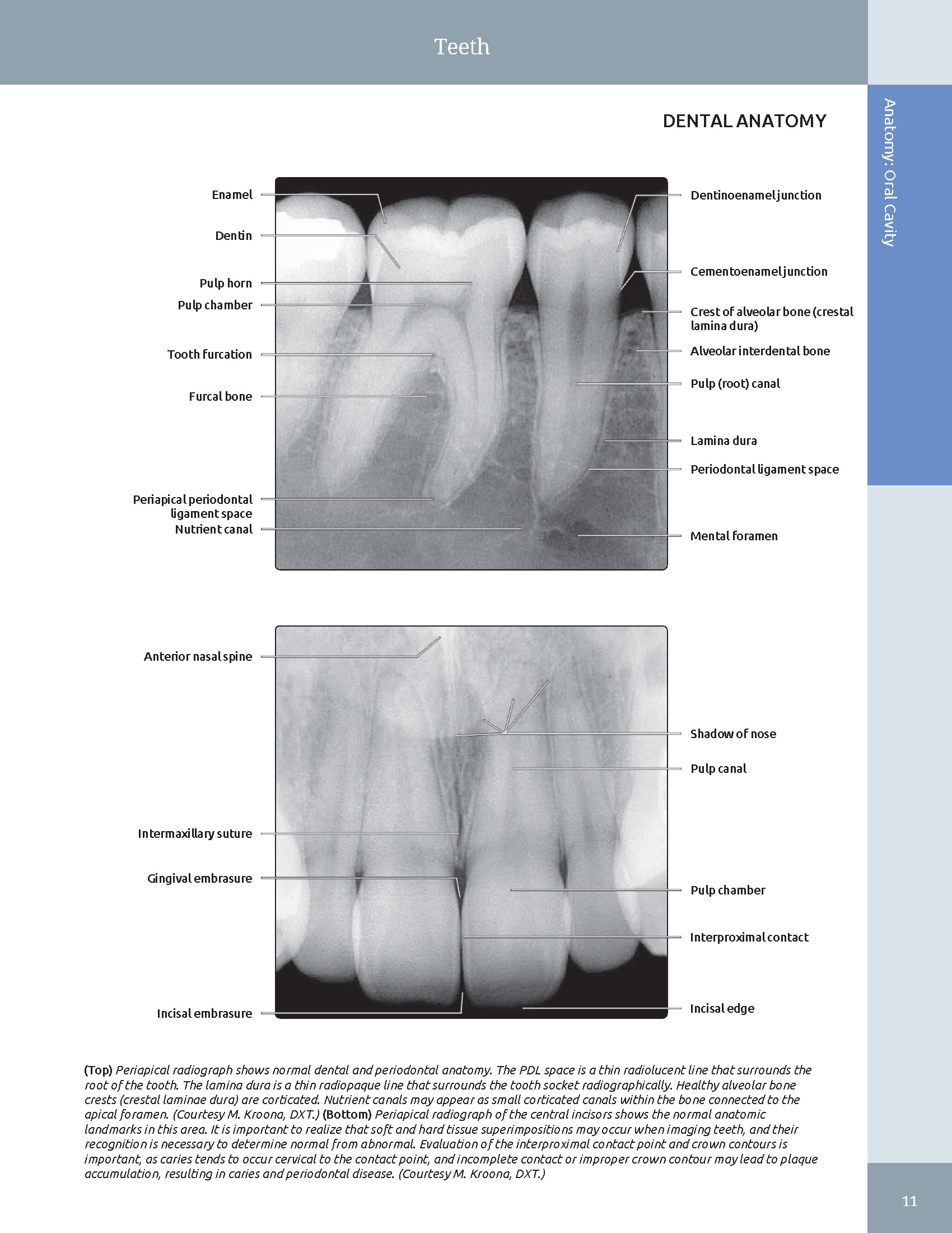 Pages from 48 Pages from Diagnostic_Imaging_Oral_and_Maxillofacial_Koenig_3e_2024_Original-2.pdf_Page_03 DIAGNOSTIC IMAGING: ORAL AND MAXILLOFACIAL - Koenig 2024 (THIRD EDITION) 2VOL - Image 8