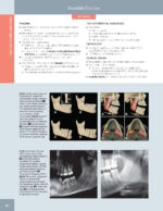 DIAGNOSTIC IMAGING: ORAL AND MAXILLOFACIAL - Koenig 2024 (THIRD EDITION) 2VOL - Image 11