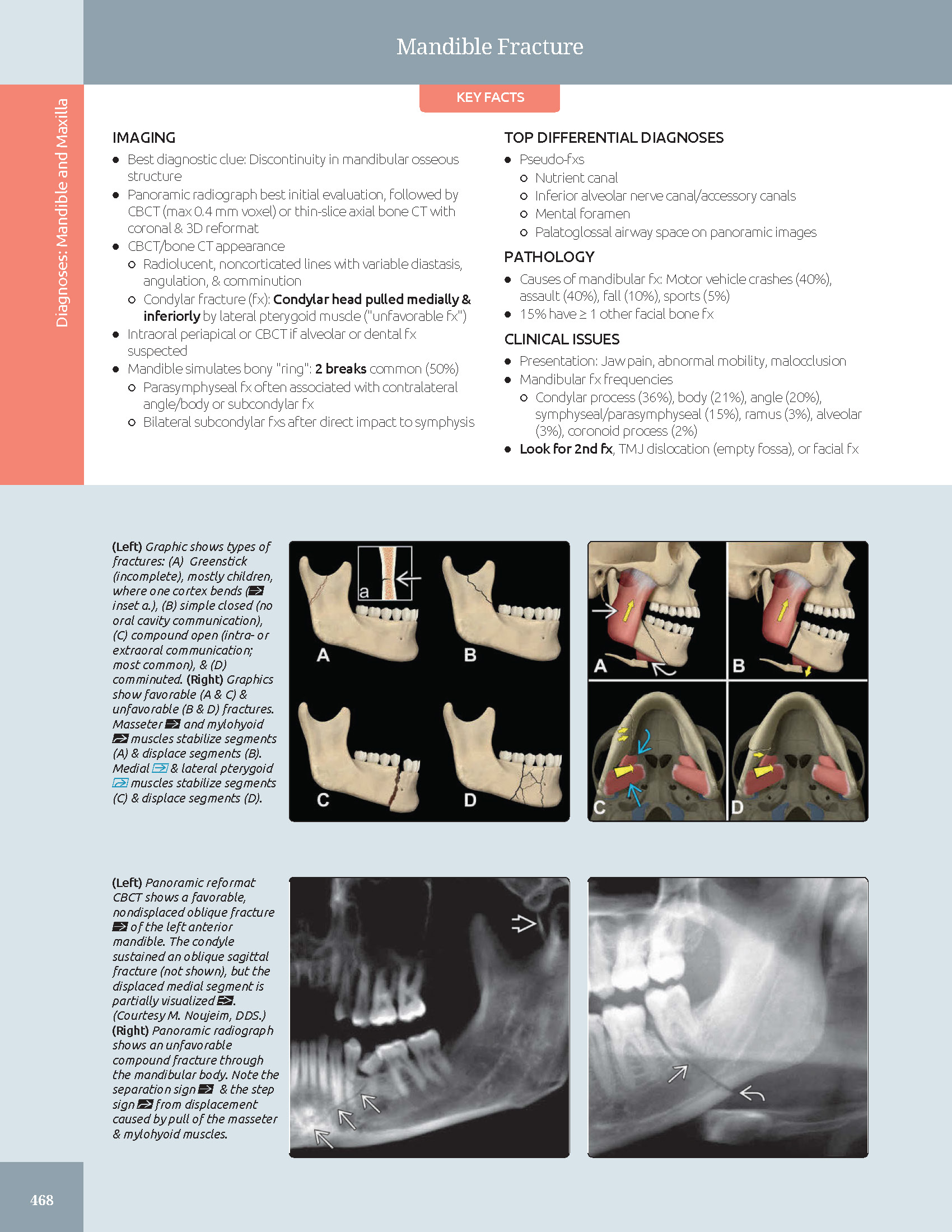 Pages from 48 Pages from Diagnostic_Imaging_Oral_and_Maxillofacial_Koenig_3e_2024_Original-2.pdf_Page_06 DIAGNOSTIC IMAGING: ORAL AND MAXILLOFACIAL - Koenig 2024 (THIRD EDITION) 2VOL - Image 11