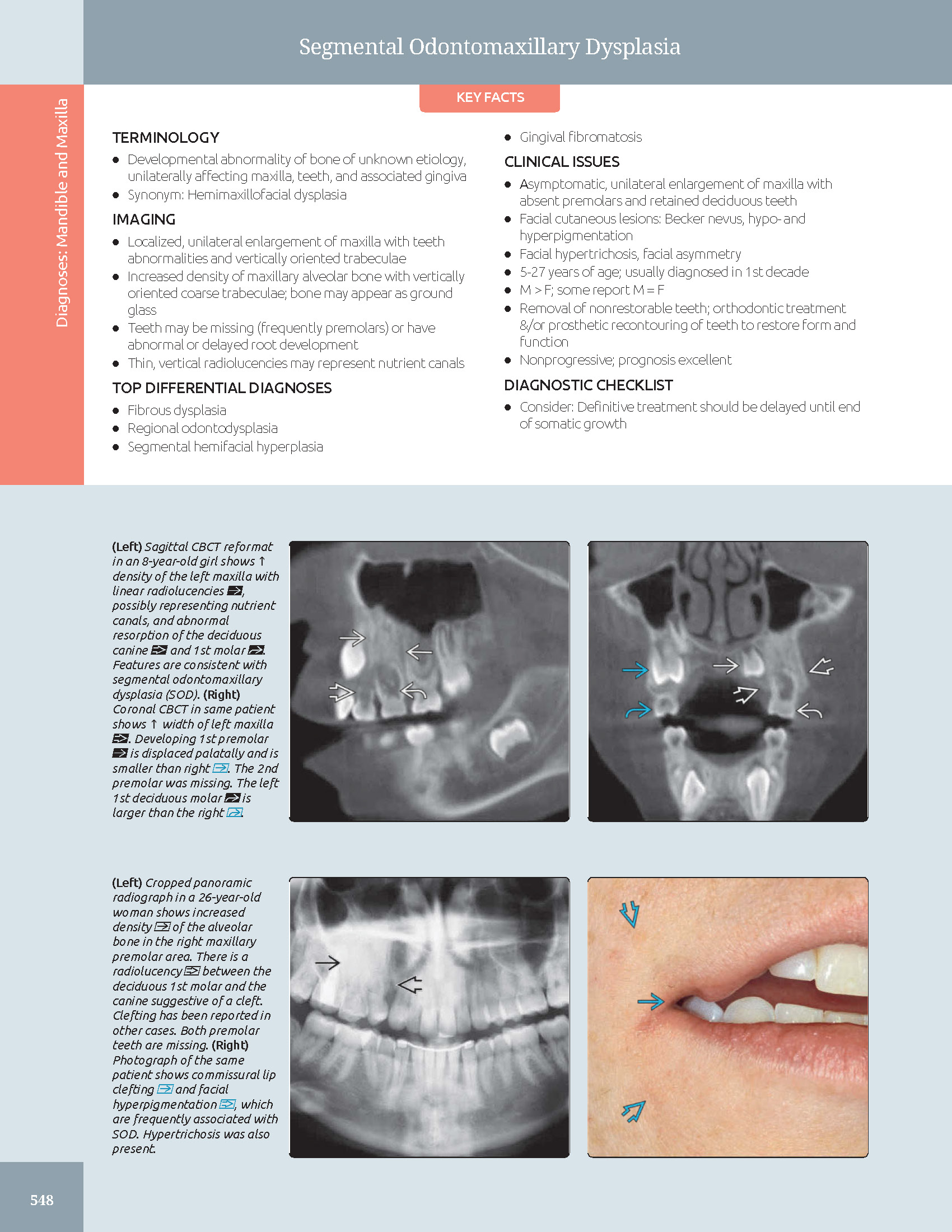 Pages from 48 Pages from Diagnostic_Imaging_Oral_and_Maxillofacial_Koenig_3e_2024_Original-2.pdf_Page_07 DIAGNOSTIC IMAGING: ORAL AND MAXILLOFACIAL - Koenig 2024 (THIRD EDITION) 2VOL - Image 12