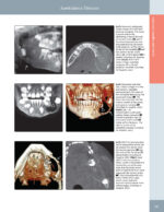 DIAGNOSTIC IMAGING: ORAL AND MAXILLOFACIAL - Koenig 2024 (THIRD EDITION) 2VOL - Image 2