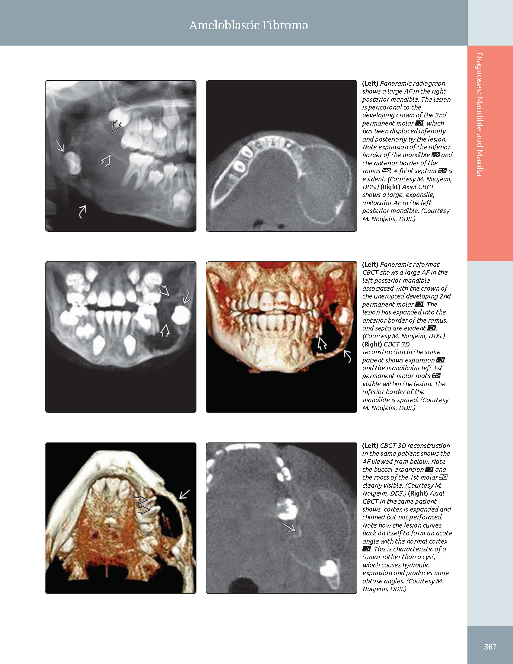 Pages from 48 Pages from Diagnostic_Imaging_Oral_and_Maxillofacial_Koenig_3e_2024_Original-2.pdf_Page_08 DIAGNOSTIC IMAGING: ORAL AND MAXILLOFACIAL - Koenig 2024 (THIRD EDITION) 2VOL - Image 2