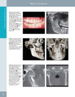 DIAGNOSTIC IMAGING: ORAL AND MAXILLOFACIAL - Koenig 2024 (THIRD EDITION) 2VOL - Image 3