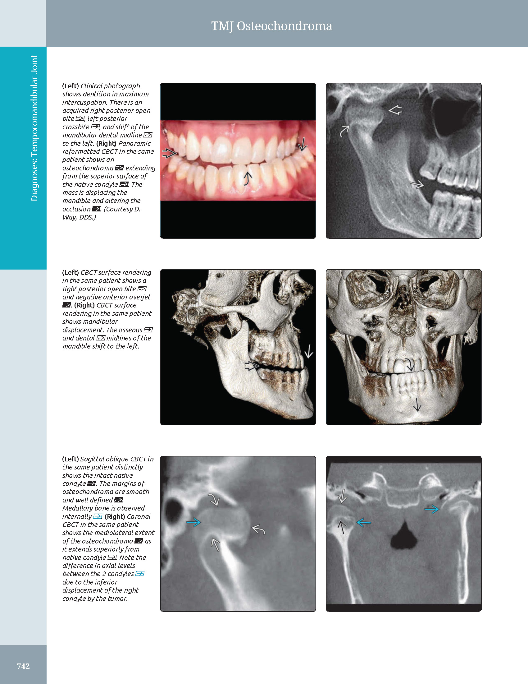 Pages from 48 Pages from Diagnostic_Imaging_Oral_and_Maxillofacial_Koenig_3e_2024_Original-2.pdf_Page_09 DIAGNOSTIC IMAGING: ORAL AND MAXILLOFACIAL - Koenig 2024 (THIRD EDITION) 2VOL - Image 3