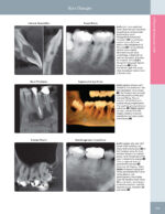 DIAGNOSTIC IMAGING: ORAL AND MAXILLOFACIAL - Koenig 2024 (THIRD EDITION) 2VOL - Image 4