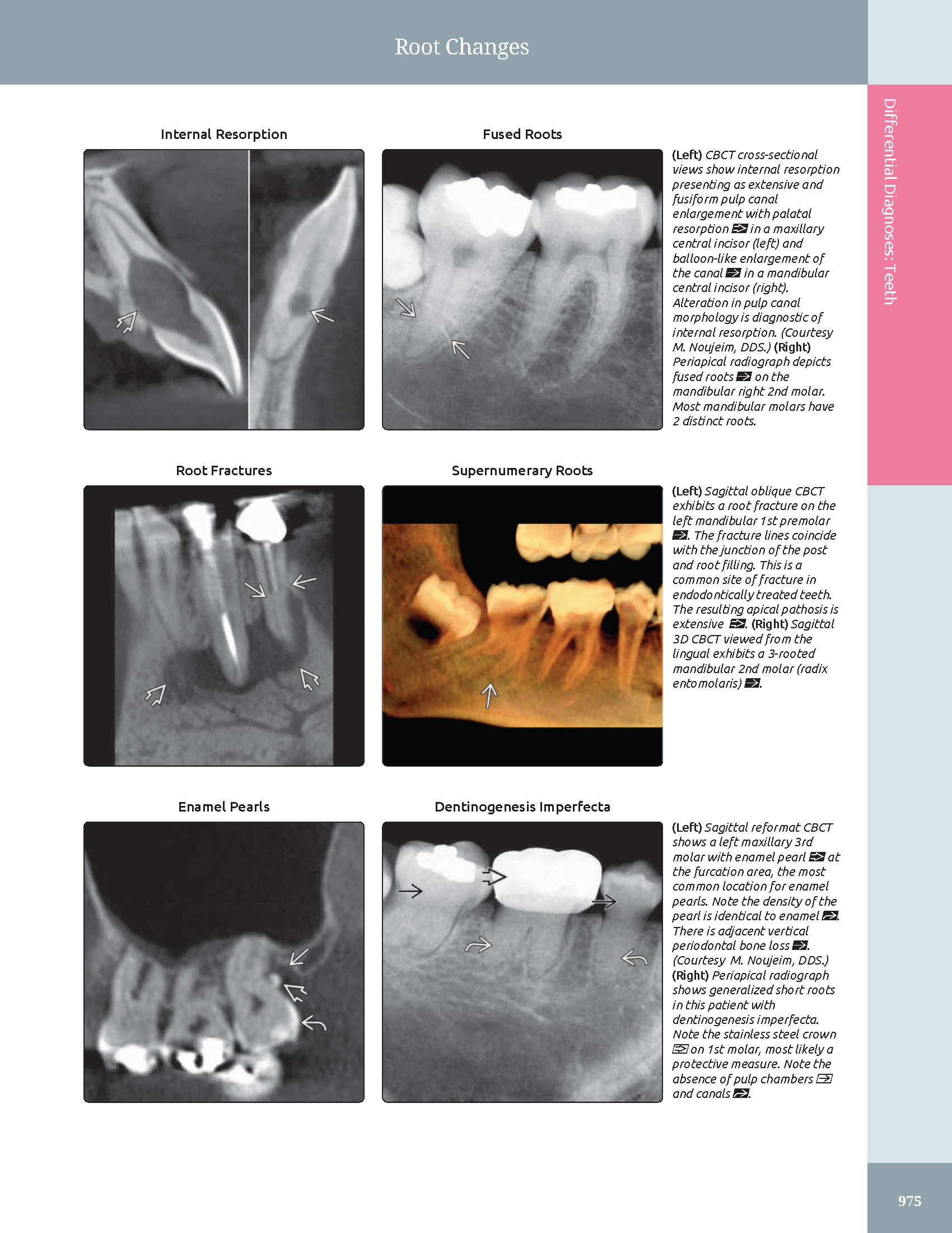 Pages from 48 Pages from Diagnostic_Imaging_Oral_and_Maxillofacial_Koenig_3e_2024_Original-2.pdf_Page_10 DIAGNOSTIC IMAGING: ORAL AND MAXILLOFACIAL - Koenig 2024 (THIRD EDITION) 2VOL - Image 4