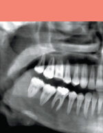 DIAGNOSTIC IMAGING: ORAL AND MAXILLOFACIAL - Koenig 2024 (THIRD EDITION) 2VOL - Image 5