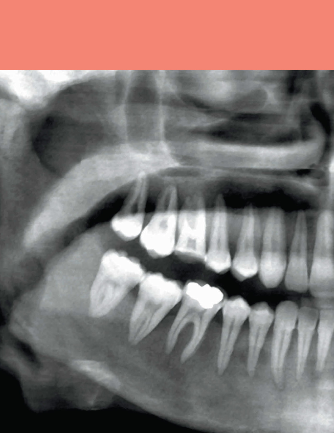 Pages from 48 Pages from Diagnostic_Imaging_Oral_and_Maxillofacial_Koenig_3e_2024_Original-2.pdf_Page_11 DIAGNOSTIC IMAGING: ORAL AND MAXILLOFACIAL - Koenig 2024 (THIRD EDITION) 2VOL - Image 5
