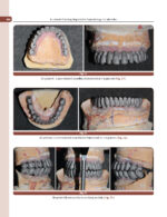 Treatment Planning Steps in Oral Implantology: A Color Atlas - Image 2
