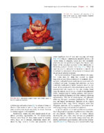 Principles of Tissue Engineering -5th Edition- 2020 (2 Vol) - Image 2