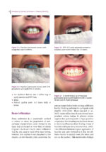 Handbook of Clinical Techniques in Pediatric Dentistry 2022 - Image 5