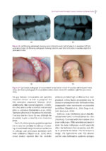 Handbook of Clinical Techniques in Pediatric Dentistry 2022 - Image 6